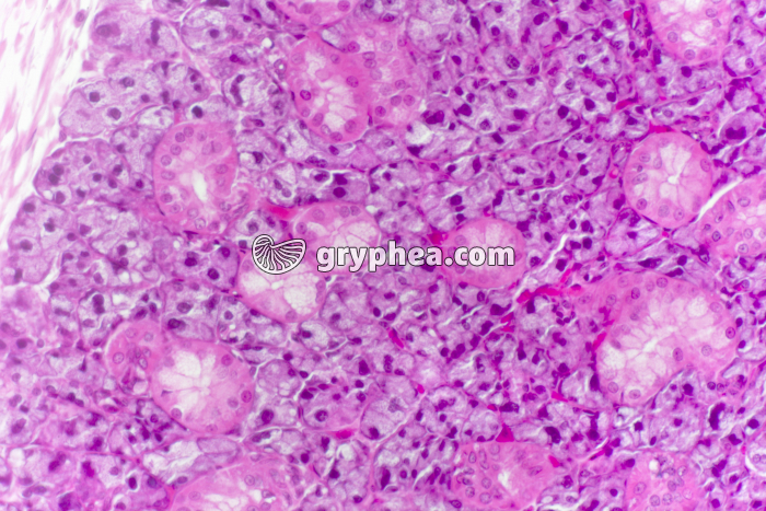 Parathyroïde x100 - gryphea.com